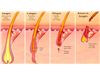 Cosmedico skinPULSE 900 RF IPL-RF