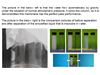 Emulsified Oil Separation Membrane