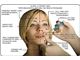 BOTOX® (onabotulinumtoxinA) allergan